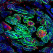 Chromosomes are microscopic bodies into which the protoplasmic substance of a cell nucleus separating during cell division.